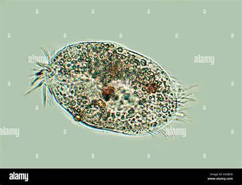  Quantitative Ciliate: Discover the Microscopic Marvel Hiding in Your Backyard Pond!